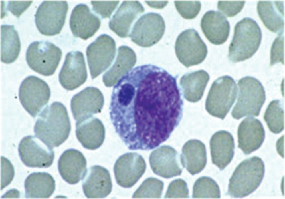 Micrograph displaying morulae detected in a monocyte on a peripheral blood smear, associated with E. chaffeensis infection.