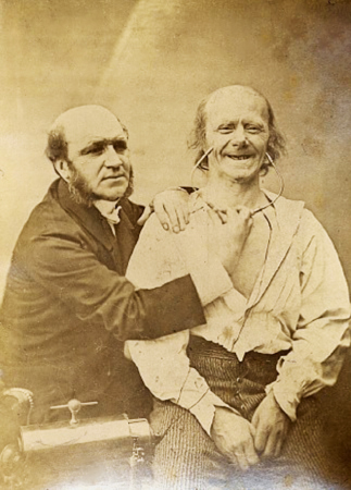 Photograph of a male surgeon checking on a male patient who is faking a smile.