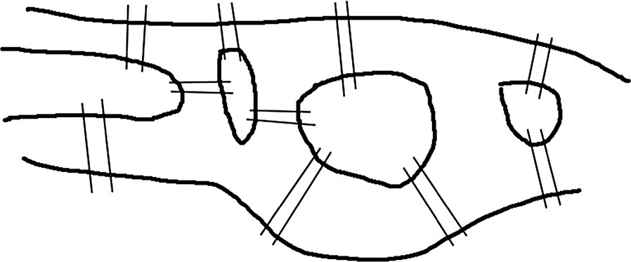 Diagram illustrating ten bridges connecting five land masses.
