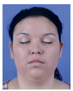 HIGHLIGHT APPLIED TO BROW BONE AND CENTER OF EYELID