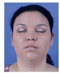 SHADOW APPLIED TO EYELID AND CREASE