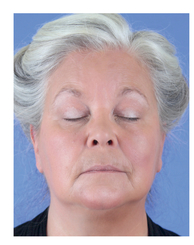 HIGHLIGHT APPLIED TO BROW BONE AND CENTER OF EYELID