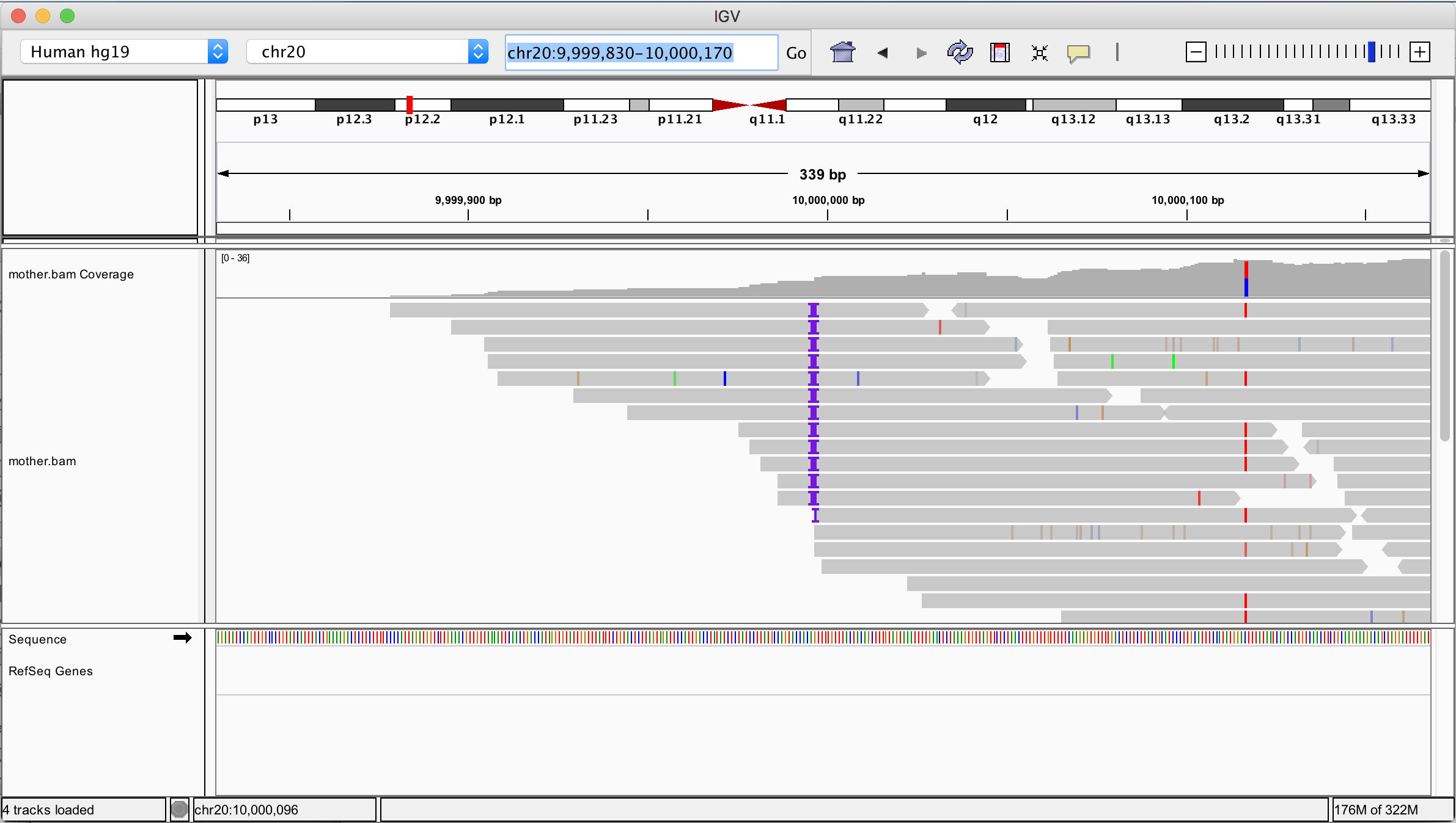 Figure 4 28  IGV view of BAM file located in a GCS bucket