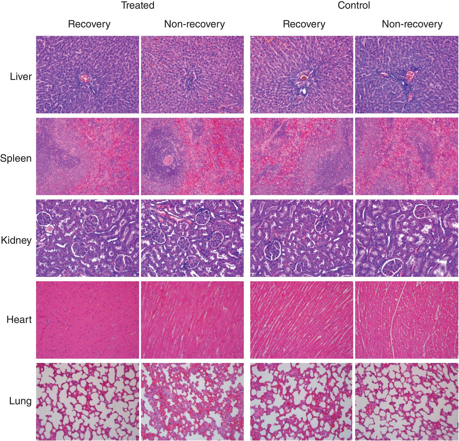 Micrographs displaying histopathological examination results of the liver, spleen, kidney, heart, and lung tissue sections of FND‐injected (treated) and saline-injected (control) rats with and without recovery.