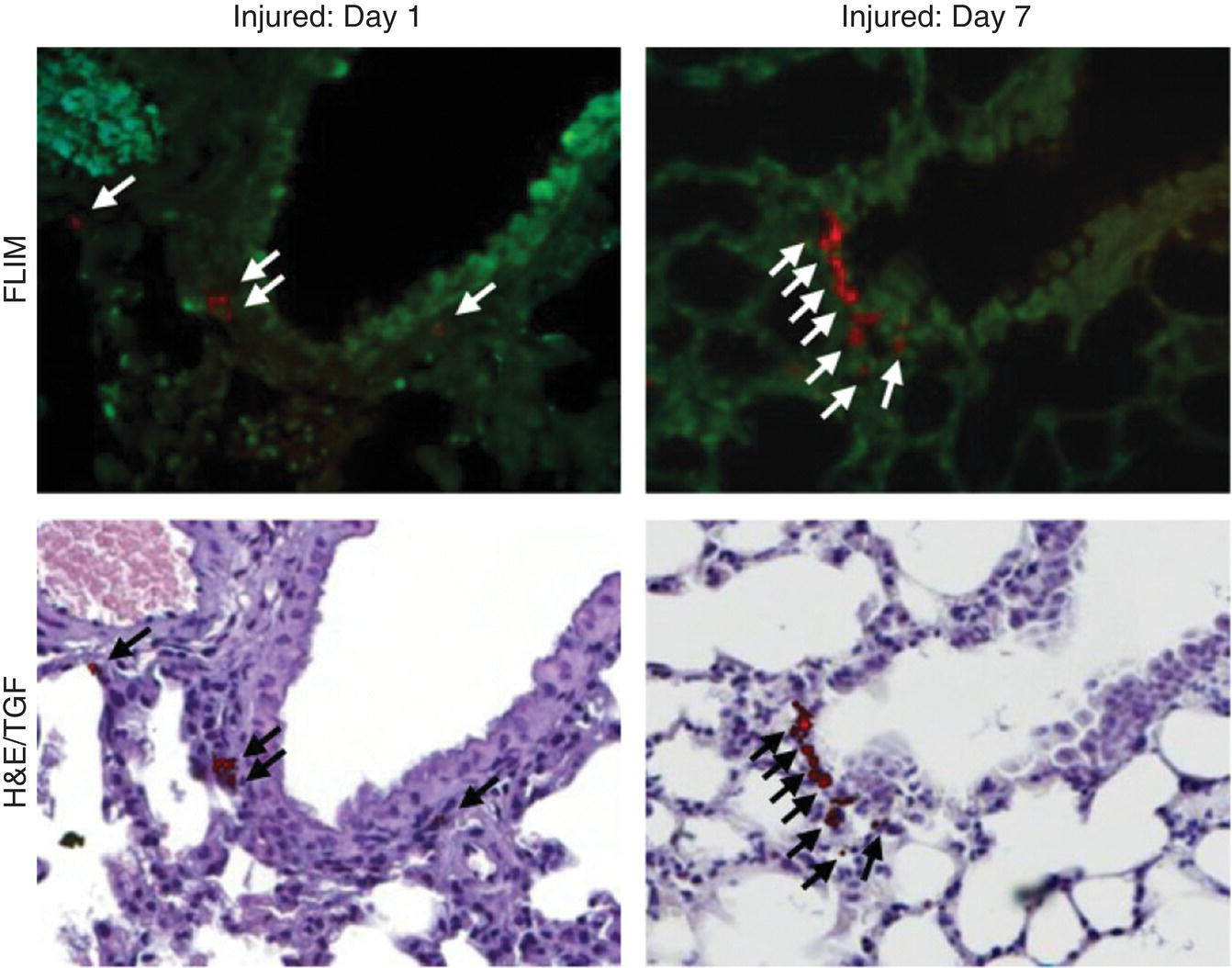 4 Photos displaying FLIM images (top) and their corresponding H&E/TGF images (bottom) of the lung tissue collected on days 1 (left) and 7(right). Each image has arrows indicating the identified cells.